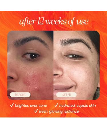 Mudita Earth Glow From Within Skincare Bundle Vitamin C Cleanser + Pineapple Bright Serum + Squalane Face Cream | Complete Brightening Even Tone & Radiance Routine - Buy Online on GoSupps.com