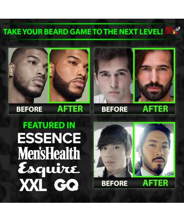 GROW Beard Roller Growth Kit - Ultimate Beard Kit for Men | Stimulate Hair Follicles & Boost Growth | Suitable for All Skin Types | Ships Internationally - Buy Online on GoSupps.com