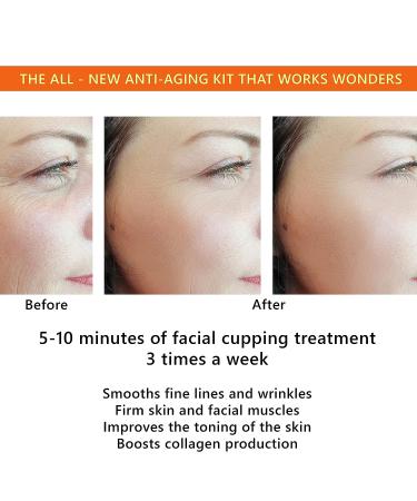Facial Cupping Set for Face and Neck + Konjac Sponge - Anti Cellulite Therapy Set | DoSensePro - Buy Online on GoSupps.com