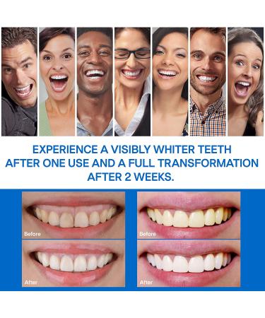 Teeth Whitening Strips Kit - 32 White Strips for Non-Sensitive Teeth Whitening, Removes Stains for up to 10 Shades Whiter - Buy Online on GoSupps.com