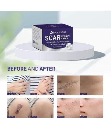 MURASAKI BEAUTY Scar Cream - Stretch Mark & Scar Removal Treatment - 1 oz. / 30g - Buy Online on GoSupps.com