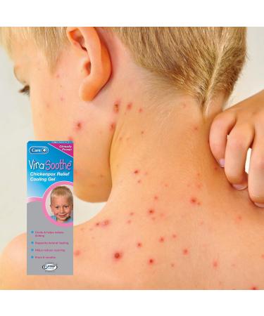 Care 50g Virasoothe Chickenpox Relief Cooling Gel - Fast Soothing Relief - Buy Online on GoSupps.com