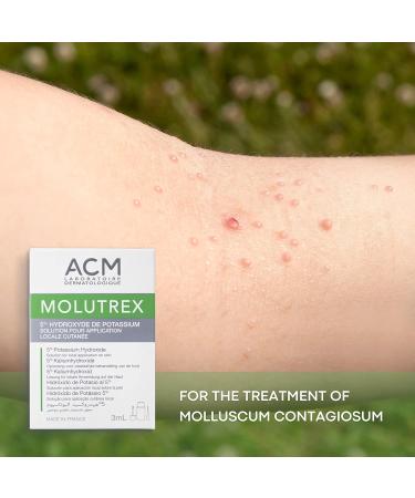 Molutrex Molluscum Contagiosum Treatment 3ml - Fast & Effective Relief - Buy Online on GoSupps.com