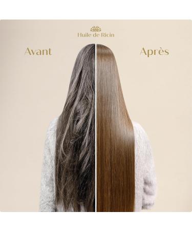 Arganicare | Duo Shampoo + Conditioner | Castor | Growth Accelerator | Gently Cleans & Moisturizes Hair | All Hair Types | 1x400 ML+ 1x400mL - Buy Online on GoSupps.com