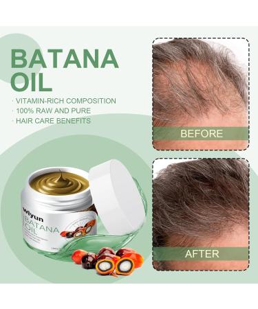 Natural Raw Batana Hair Oil Conditioner - Organic Hair Growth & Moisturizing Scalp Treatment for Men & Women - Prevent Hair Fall & Restore Damaged Hair 3.52FL. OZ - Buy Online on GoSupps.com