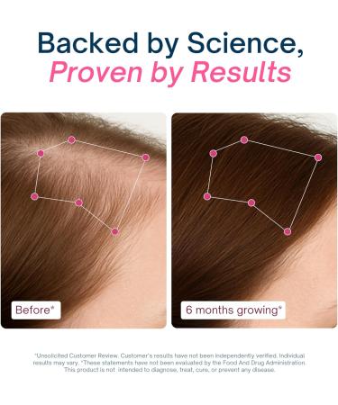 ALTAGAMMA Hair Growth Supplements - Nourishes Thinning Strengthen Nails & Skin & Combat Hair Loss - Hair Growth Vitamins for Women & Men with Marine Collagen Peptides 60 Capsules | 30 Day Supply - Buy Online on GoSupps.com