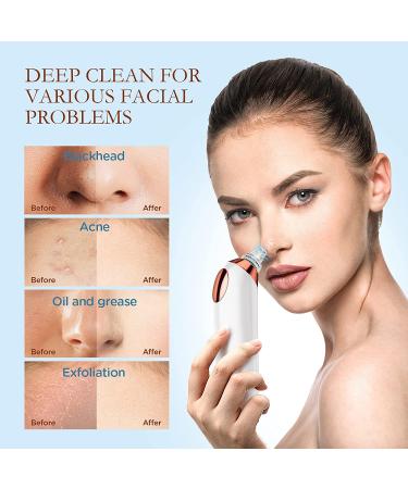 Blackhead Remover Vacuum Pore Cleaner with 5 Suction Power & 5 Probes - Electric USB Rechargeable Extractor for Facial Acne, Whitehead, and Comedone Removal - Includes Hot Compress & 3 Beauty Lamps - Siyaluens Model2 - Buy Online on GoSupps.com