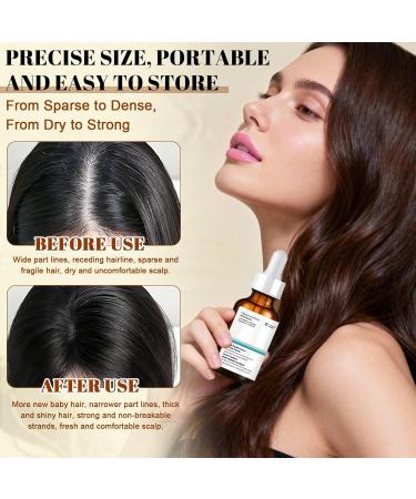 Multi-peptide Serum for Hair Density Peptides Hair Growth Serum Pousse de Cheveux Pr vient la Chute Des Cheveux Rafra chissant et Non Gras Convient Aux Hommes et Aux Femmes 30ml - Buy Online on GoSupps.com