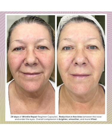 Droplette Wrinkle Repair Refill Capsules | Anti-Aging Face Smoothing & Firming with Collagen & Retinol - Reduces Fine Lines & Wrinkles (28 Count - Buy Online on GoSupps.com