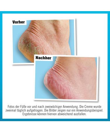 O'Keeffe's OKeeffes Healthy Feet Voetcr me Tube 80 ml 2 Pack - Buy Online on GoSupps.com