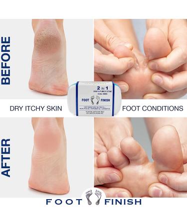 2-in-1 Athlete's Foot Treatment: Pumice Stone & Tea Tree Oil Foot Soap for Itchy & Stinky Feet - Men's Callus & Dead Skin Remover - Buy Online on GoSupps.com