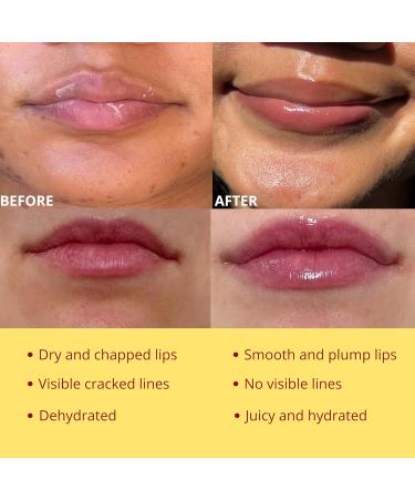 Original My Bee Balm Lip Balm - Propolis Hydrating Balm Honey Pot for Dry Chapped & Cracked Lips with Propolis Honey & Vitamin E - Soften Smooth & Reduce Lip Lines Honey 1 Count (Pack of 1) - Buy Online on GoSupps.com