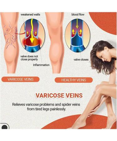 Royalaura Medical Grade Compression Stockings - Varicose Vein Relief Calf Sleeves for Men & Women (M Yellow) - Footless Compression Leggings - Buy Online on GoSupps.com