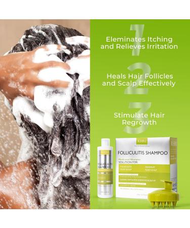 Anti-Fungal Folliculitis Shampoo for Seborrheic Dermatitis Scalp Psoriasis & Dandruff Relief - Soothes Itchy Dry Scalp - Buy Online on GoSupps.com