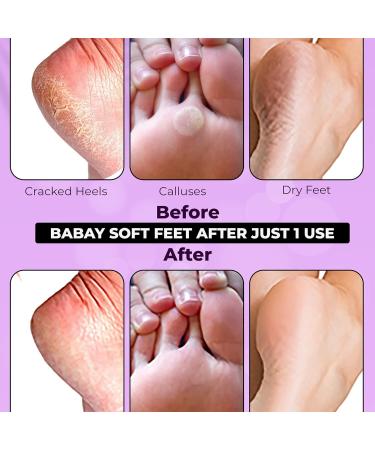 Foot Peel Mask (2 Pairs) - Exfoliating Foot Mask for Baby Soft Skin - Remove Dead Skin, Lavender Scented - Foot Care Spa Treatment for Men and Women - Buy Online on GoSupps.com