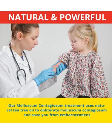 Molluscum Contagiosum Treatment - Fast, Safe, Painless All Natural Solution for Children and Adults - 15mL - 1 Month Supply - Buy Online on GoSupps.com