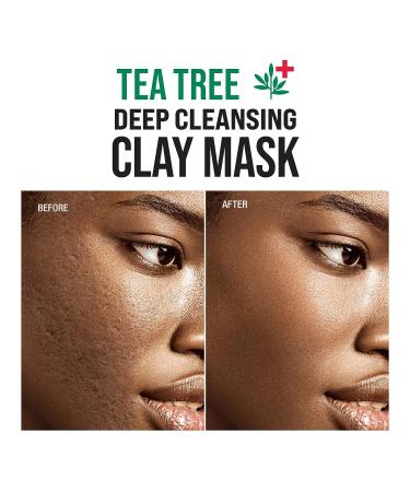 Kiss New York Tea Tree Deep Cleansing Clay Mask 4.23 oz - Korean Skin Care for Pores, Oil Control, and Impurity Removal - Buy Online on GoSupps.com