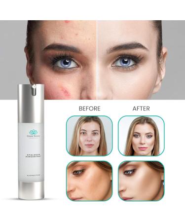 CREATE BEAUTY COSMETICS Hyaluronic Serum I 50 ml High Dose Hyaluronic Acid Concentrate I Anti-Ageing Moisturiser for Face and Skin I Natural Cosmetics Made in Germany - Buy Online on GoSupps.com
