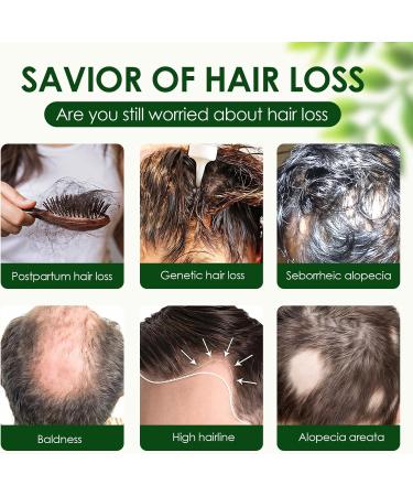 TULAMORIY Hair serum 60 ml against hair loss mens solution hair care serum hair fluid for thinning hair promotes strong and dense hair - Buy Online on GoSupps.com