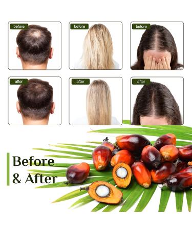 Organic Raw Batana Oil for Hair Growth | Prevent Hair Loss & Enhance Thickness | 100g - Dr. Sebi Approved - Buy Online on GoSupps.com