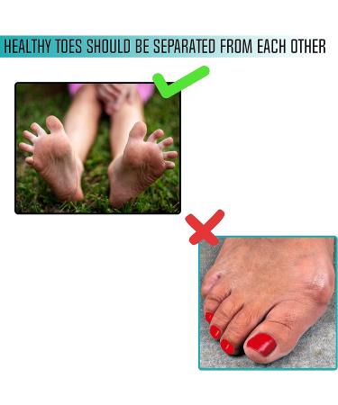 Fuertoes Hallux Valgus Resistance Bands - Set of 2 for Toe Strength & Alignment Correction - Buy Online on GoSupps.com