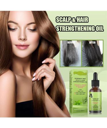 Rosemary Mint Scalp & Hair Strengthening Oil 59ml Rosemary Hair Growth Oil Rosemary Oil for Hair Growth Anti Hair Loss Fast Grow Nourish Dry Damaged Hair for Men & Women (2 pieces) - Buy Online on GoSupps.com