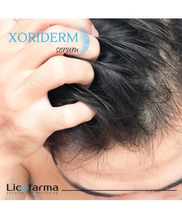 Xoriderm Scalp Serum Lotion - Soothing Relief for Psoriasis and Dermatitis - Buy Online on GoSupps.com