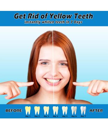 28 Teeth Whitening Strips Gentle for Sensitive Teeth Professional Effect to Remove Stains (28 Strips 14 Pouches) 28 count (Pack of 1) - Buy Online on GoSupps.com