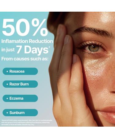 Noredol Rejuvenation Gel | Redness Relief for Oily & Blemish-Prone Skin | Patented 1 4-Cyclohexanediol + Zinc & Vitamin A | Mattifying Pore Minimizer & Antioxidant | Fragrance-Free (1 oz) 1 Ounce (Pack of 1) - Buy Online on GoSupps.com