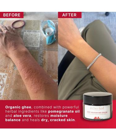 Inherited Deep Nourishing Cream | Daily Moisturizer for Dry Extremely Dry & Sensitive Skin | Ancient Indian Hydrating Skincare w/Washed Ghee for Face & Body | Skin Repair Cream for Men & Women 50ml - Buy Online on GoSupps.com