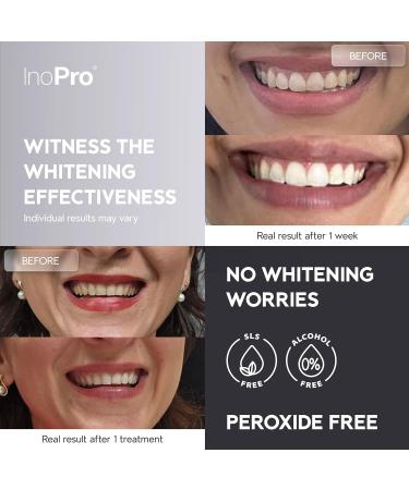 2-in-1 Teeth Whitening Strips Kit 35 Treatments - Advanced Teeth Whitening Kit (14 Treatments) + Innovative Teeth Whitening Kit (21 Treatments) - Buy Online on GoSupps.com