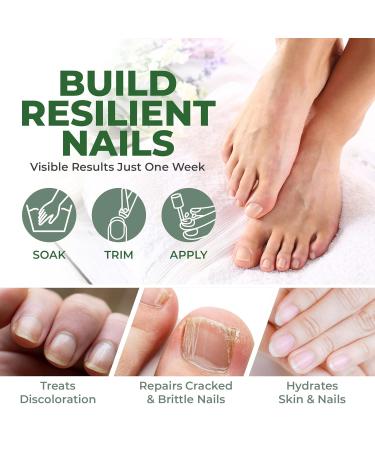 Perfecto Tea Tree Oil Toenail & Fingernail Treatment - Extra Strength Nail Repair for Yellow & Cracked Nails - 0.50 Fl Oz (Pack of 2) - Buy Online on GoSupps.com