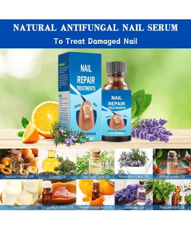 Fungal Nail Treatment 30ML Nail Fungus Serum for Toenail Extra Strong Gentle Anti Fungal Nail Serum Protects Thick Broken Discolored Nails Restoring Healthy Nails For Finger And Toe Nail Fungal - Buy Online on GoSupps.com