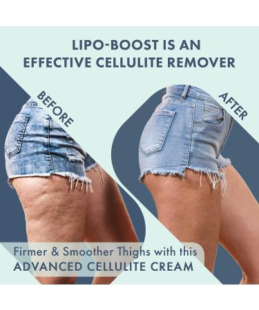 WeightLoss-Solutions Lipo-Boost Cellulite Cream with Caffeine - Advanced Firming Lotion for Thighs, Butt, Stomach, Breasts, Arms - Smooth, Firm, Tone, Tighten - Buy Online on GoSupps.com