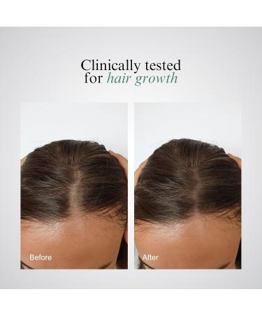 Collagen Hair Treatment - Bevanni powerFOL for Stronger Healthier Hair | International Shipping Available - Buy Online on GoSupps.com
