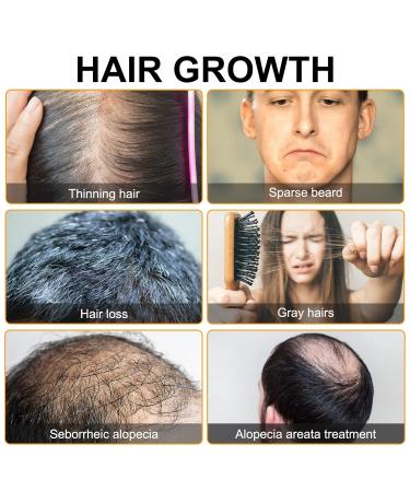 Buy Hair Growth Foam for Men & Women | With Biotin & Capilia Longa | Effective Hair Regrowth Treatment for Thicker Stronger Hair | Stop Hair Thinning - Buy Online on GoSupps.com