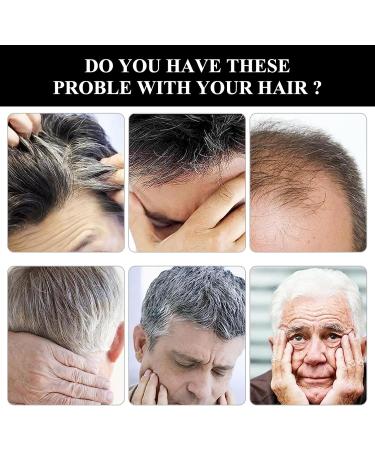 Anti Gray Bar 2 Pieces Shiny Soap for Gray Hair Bamboo Charcoal Hair Soap Solid Shampoo Bar Natural Hair Soap for Gray Hair Darkening Solid Hair - Buy Online on GoSupps.com