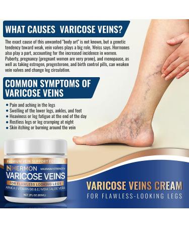 Hermon Varicose Veins Cream - Natural Treatment for Pain Relief and Soothing Leg Varicose & Spider Veins - 2 Oz - Buy Online on GoSupps.com