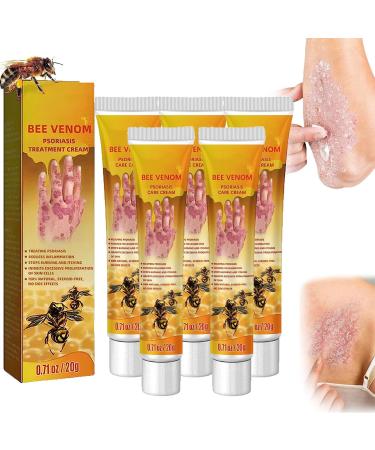 GIMMAV Bee Venom Psoriasis Treatment Cream New Zealand Bee Venom Professional Psoriasis Treatment Cream Soothing Psoriasis Cream Psoriasis Treatment for Skin Suitable for All Skin Types (5PCS)