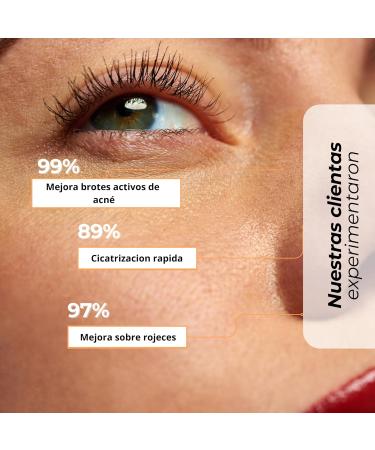  Nonna Cosmetics NONNA COSMETICS Miracle H - Hypochlorous acid spray for cosmetic use 100 ml - Buy Online on GoSupps.com