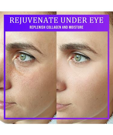 W BEAUTY Collagen Under Eye Patches - 30 Pairs Hydro Gel Masks for Puffy Eyes, Under Eye Bags - Moisturizing and Hydrating with Tweezers - Buy Online on GoSupps.com