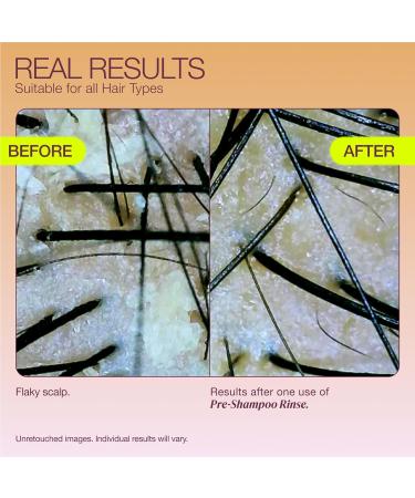 Pre-Shampoo Clarifying Scalp Treatment with AHA & Apple Cider Vinegar - 4oz | Healthy Scalp Solution - Buy Online on GoSupps.com