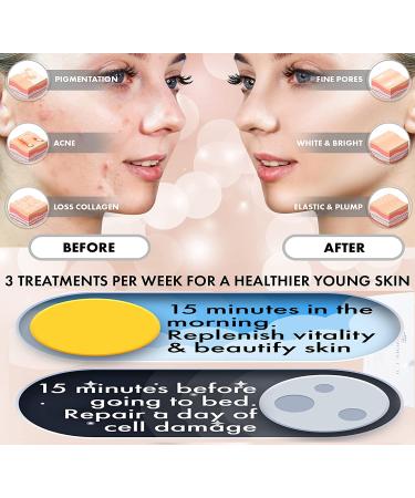 FDA Cleared 8-in-1 LED Light Therapy Face Mask for Anti-Aging & Dark Spot Removal + Ice Roller - Rose Gold - Buy Online on GoSupps.com