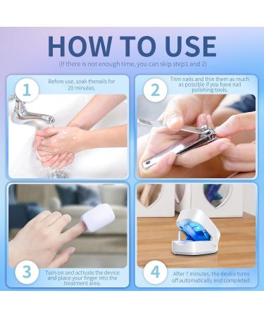 Nail Fungus Cleaning Light Device - Effective Rechargeable Remedy for Damaged Discolored Toenails & Fingernails - Fast Shipping Worldwide - Buy Online on GoSupps.com
