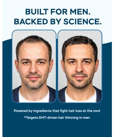 4Well Products Saw Palmetto for Men & Prostate Health Supplements with Arjuna Extract - Advanced Formula Saw Palmetto & Arjuna Bark Extract w/DHEA & Ashwagandha 900mg - DHT Blocker for Hair Support - Buy Online on GoSupps.com