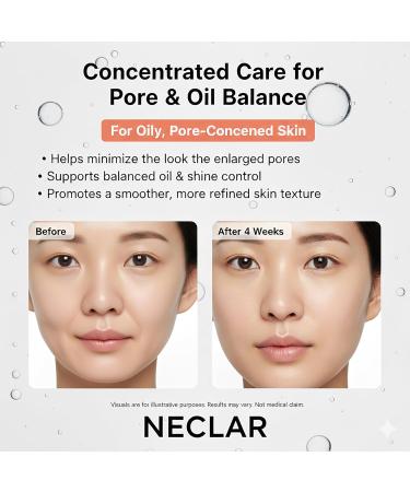 Niacinamide Serum for Face - 15% Niacinamide with Vitamin C Glutathione - Korean Dark Spot Serum for Uneven Tone Enlarged Pore Dullness Ance-Prone Sensitive Skin - Fragrance-Free Daily Use - Buy Online on GoSupps.com