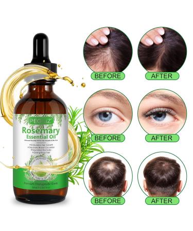 Premium Rosemary Oil for Hair Growth & Skin Care | Bio-Rosmarin Oil with Scalp Massager & Essential Oil for Eyelashes & Body Massage - Shop Now! - Buy Online on GoSupps.com