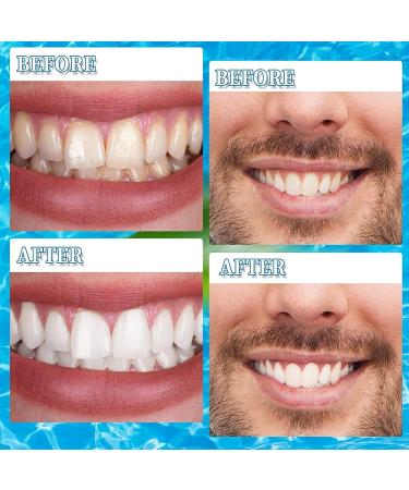 Buy Mxrfactory Teeth Prosthesis - Natural Tone Pebble Veneers for Men & Women | Upper & Lower Removable Teeth Whitening | 8 Pairs Comfortable Smile Makeover - Buy Online on GoSupps.com