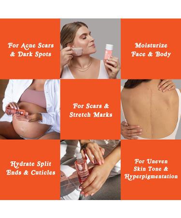 Bio-Oil Skincare Body Oil Serum - Scar & Stretchmark Moisturizer with Vitamins A & E - 4.2 oz - Buy Online on GoSupps.com