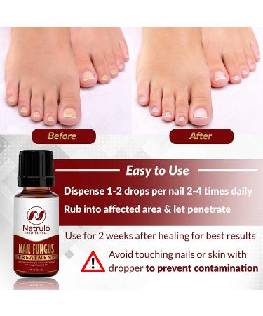 Natural Anti Fungal Nail Balm with Tea Tree Oil | Nail & Toenail Fungus Treatment | Made in USA - Buy Online on GoSupps.com